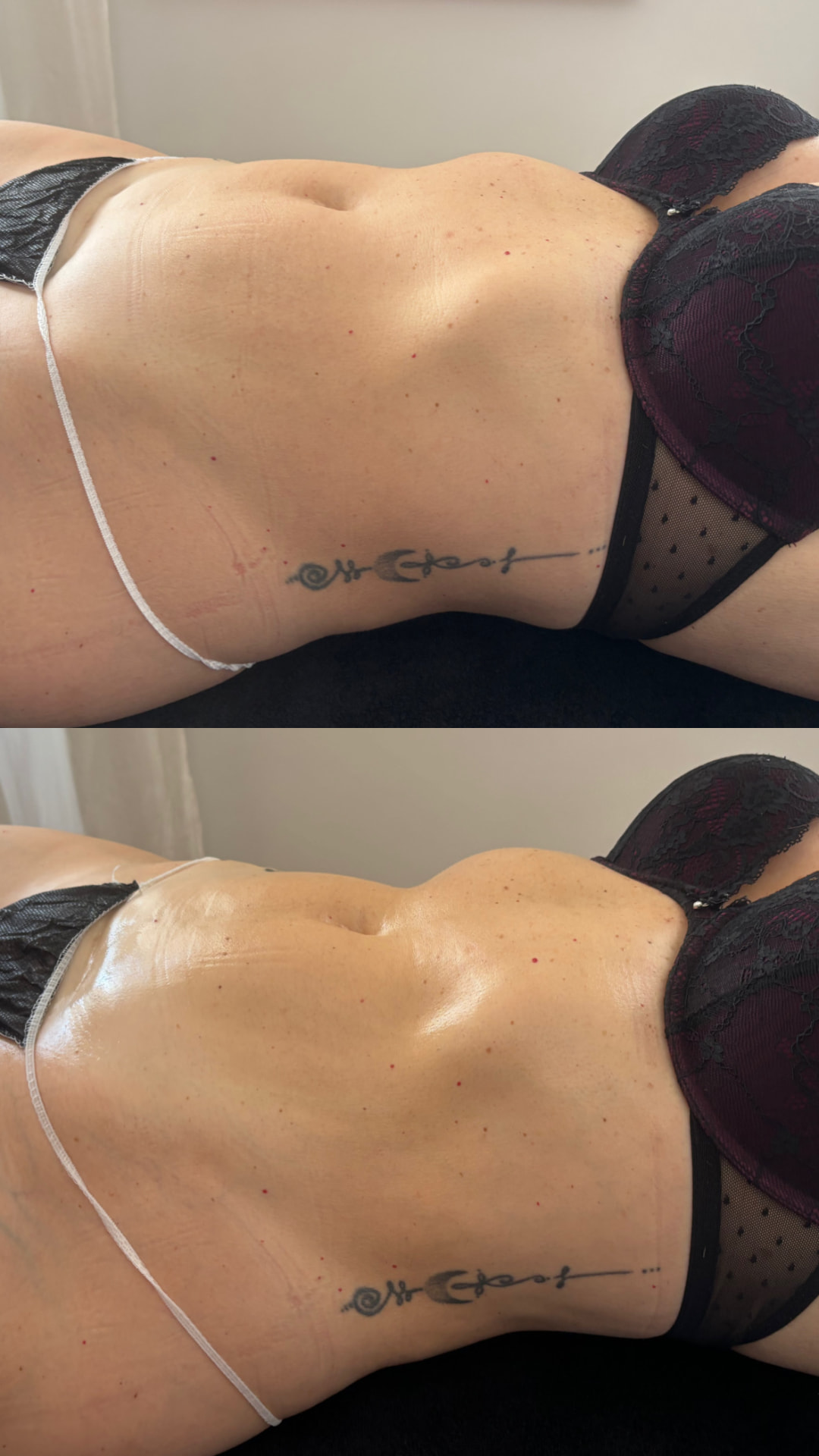 Antes y después de Maderoterapia corporal a domicilio